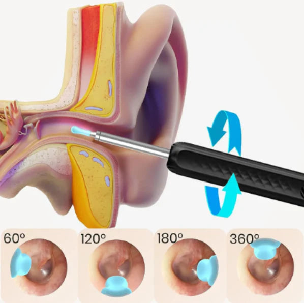 CleanEars CamPro ™|Limpiador de oidos con camara HD