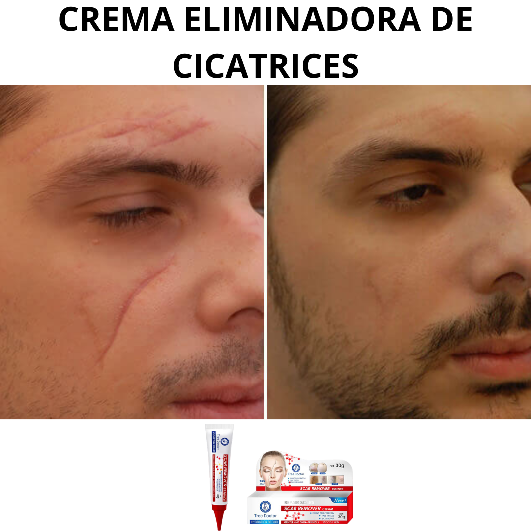 ScarErase Pro™|Crema Eliminadora de Cicatrices