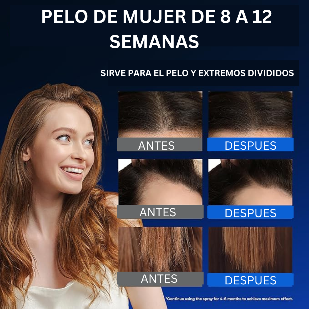 Hair Growth Serum™|Suero para el crecimiento del cabello y Anticaída